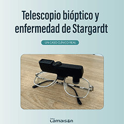 Telescopio Bi�ptico y enfermedad de Stargardt